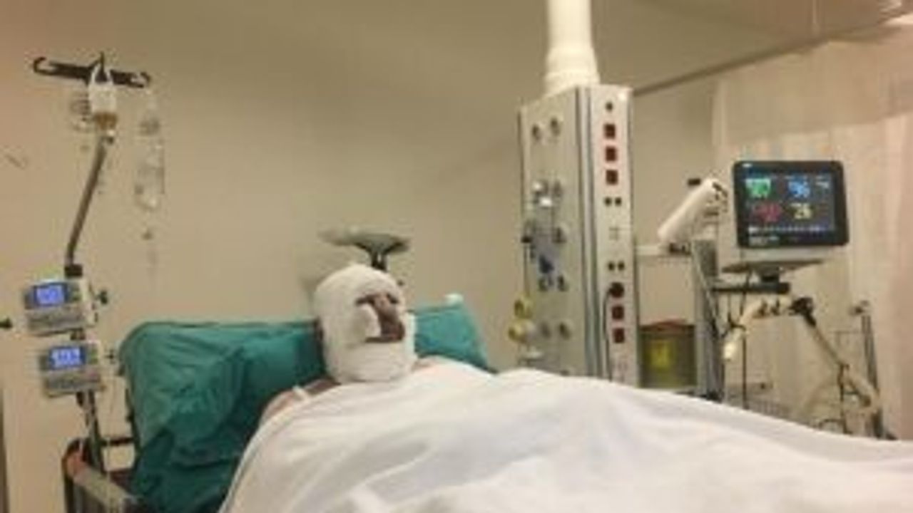 Yangında yaralanıp Eskişehir'e sevk edilmişti... O anları anlattı